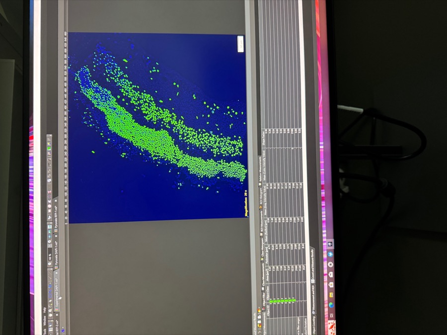 Fluorescence image analysis and cell counting