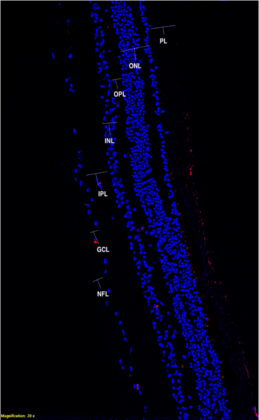 Labeled retinal cross-section under fluorescence