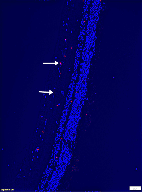TUNEL apoptosis assay of retinal tissue